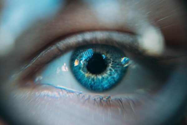 Primeros signos de retinopatía diabética en un globo ocular azul claro